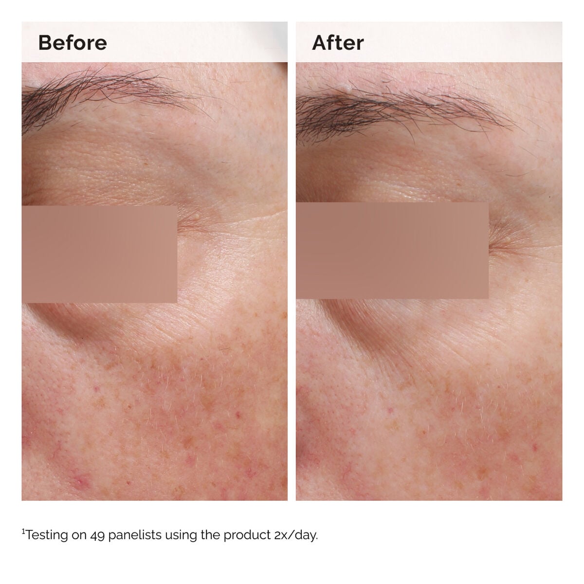 niacinamide-5-face-and-body-emulsion-i4 2024-08-23-ORD-Nia-5pct-Face-Body-B-A-Elasticity-Global-02-1x1.jpg