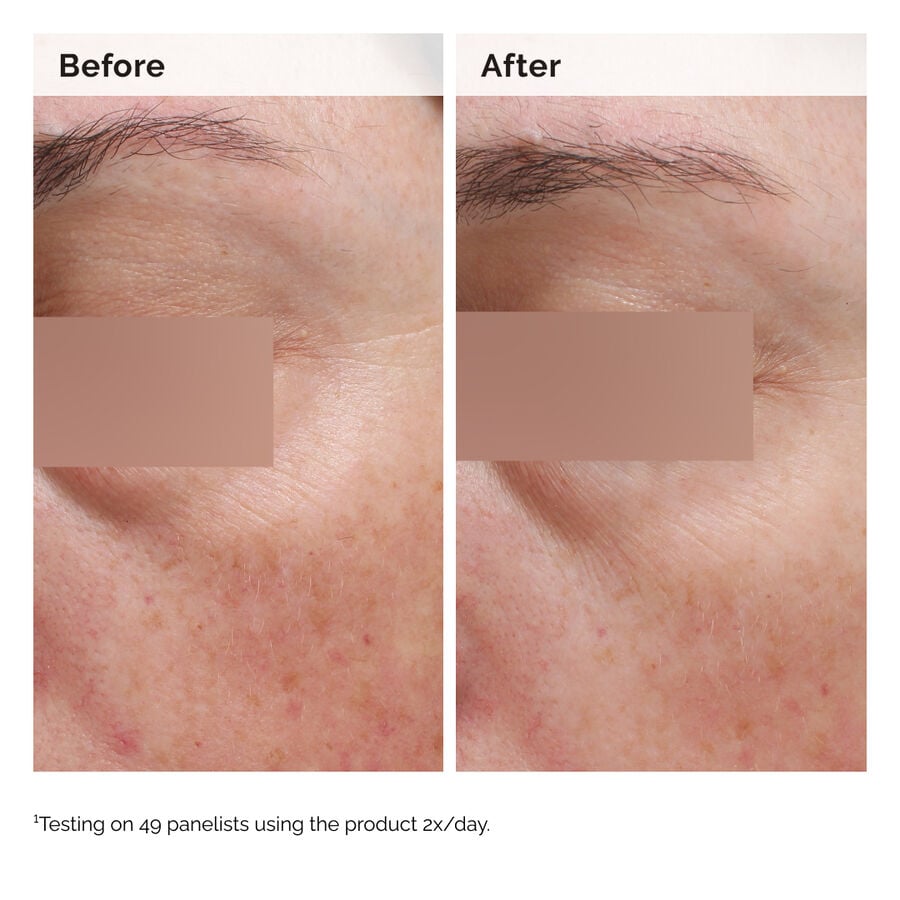 niacinamide-5-face-and-body-emulsion-i4 2024-08-23-ORD-Nia-5pct-Face-Body-B-A-Elasticity-Global-02-1x1.jpg