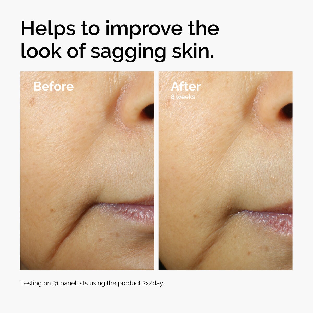 caffeine-3-escin-1-face-serum-w5 ord-caffeine-3pct-escin-1pct-face-serum-before-after-sagging.jpg
