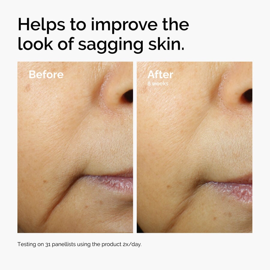 caffeine-3-escin-1-face-serum-w5 ord-caffeine-3pct-escin-1pct-face-serum-before-after-sagging.jpg