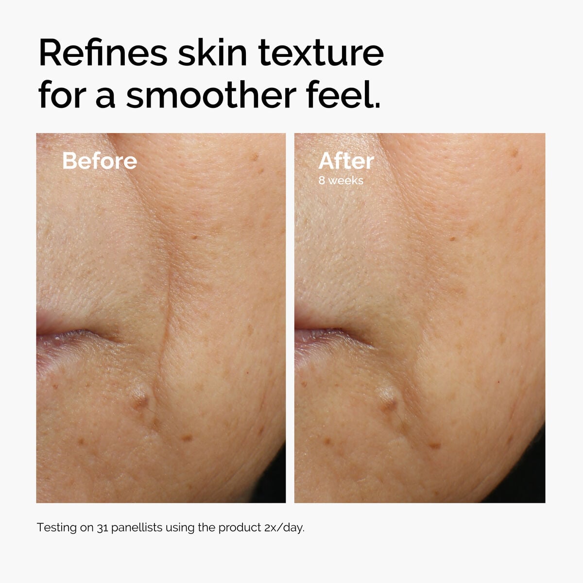caffeine-3-escin-1-face-serum-w5 ord-caffeine-3pct-escin-1pct-face-serum-before-after-texture.jpg