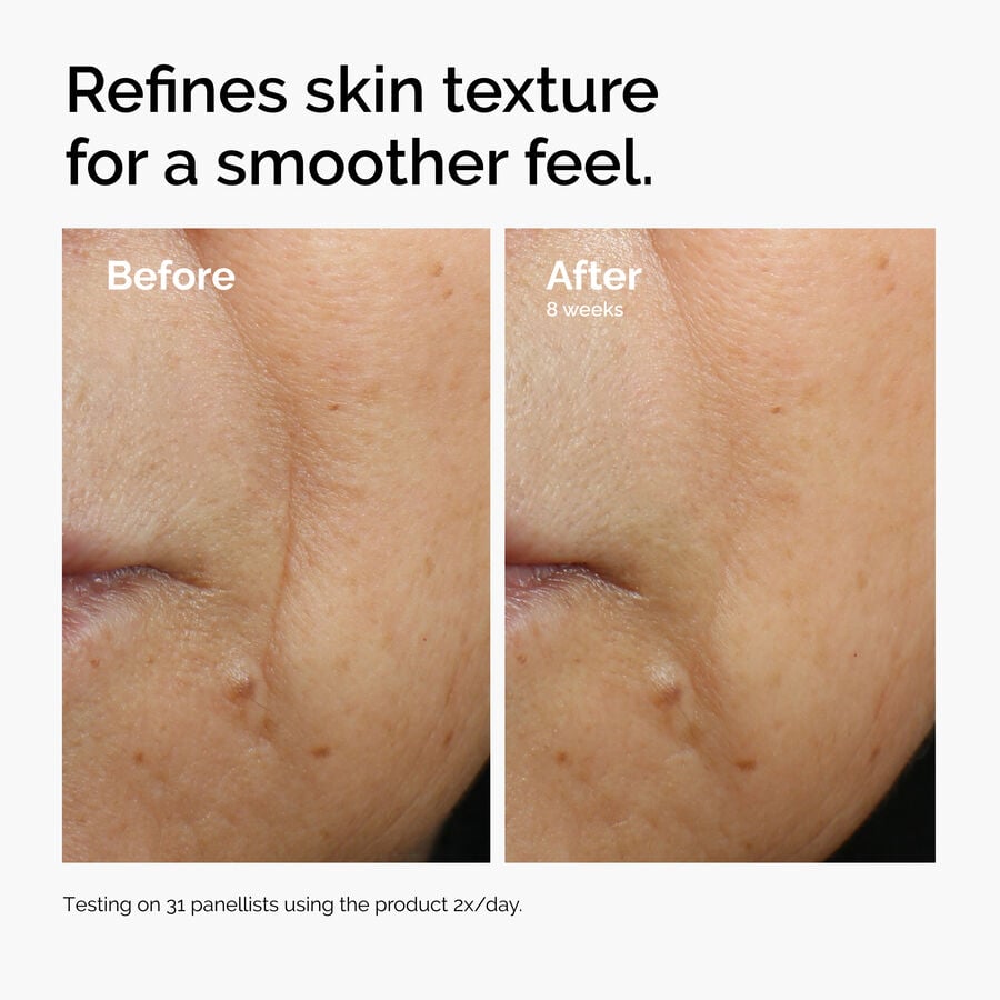 caffeine-3-escin-1-face-serum-w5 ord-caffeine-3pct-escin-1pct-face-serum-before-after-texture.jpg