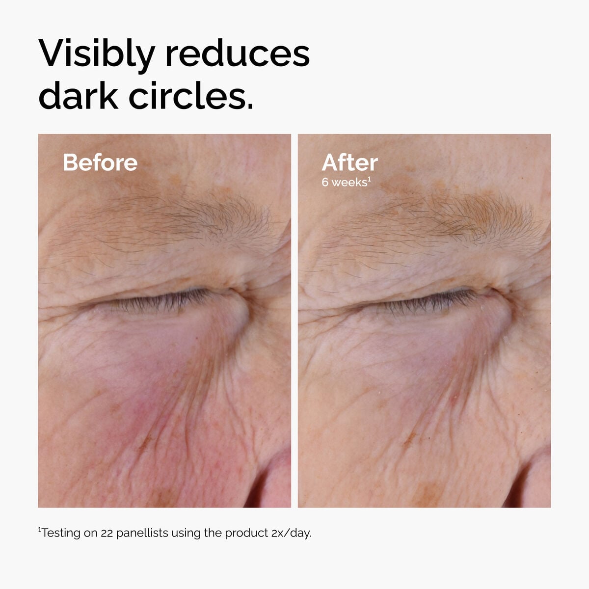caffeine-solution-5-egcg-eye-serum-p2 ord-caffeine-solution-egcg-dark-circles-before-after.jpg