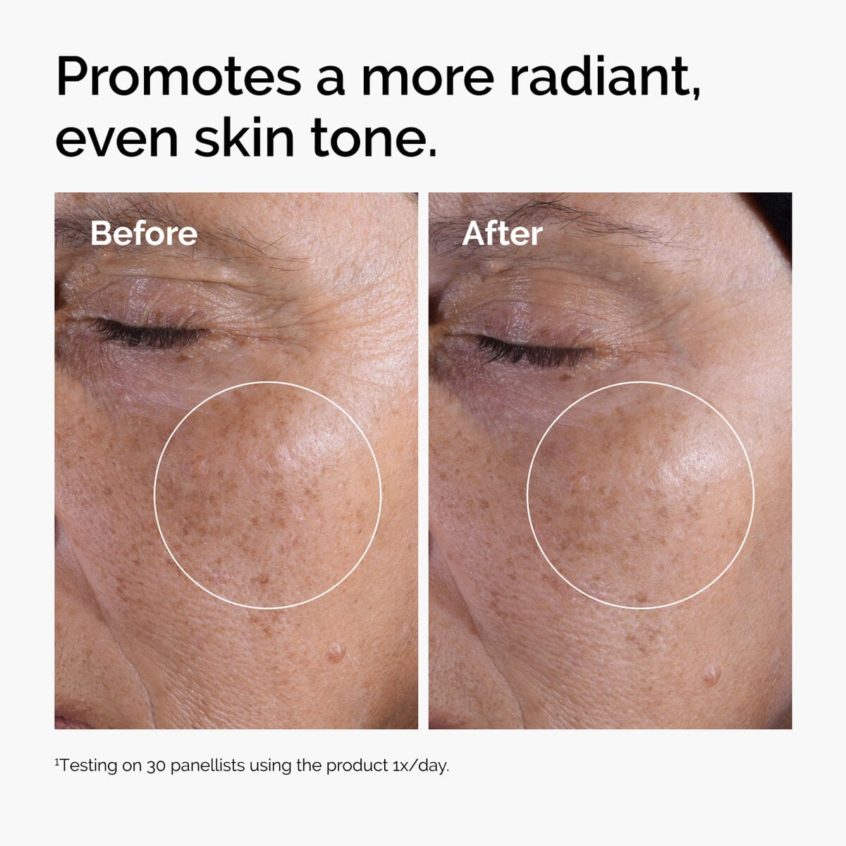 glycolic-acid-7-exfoliating-toner-e6 ord-glycolic-before-after-radiance.jpg