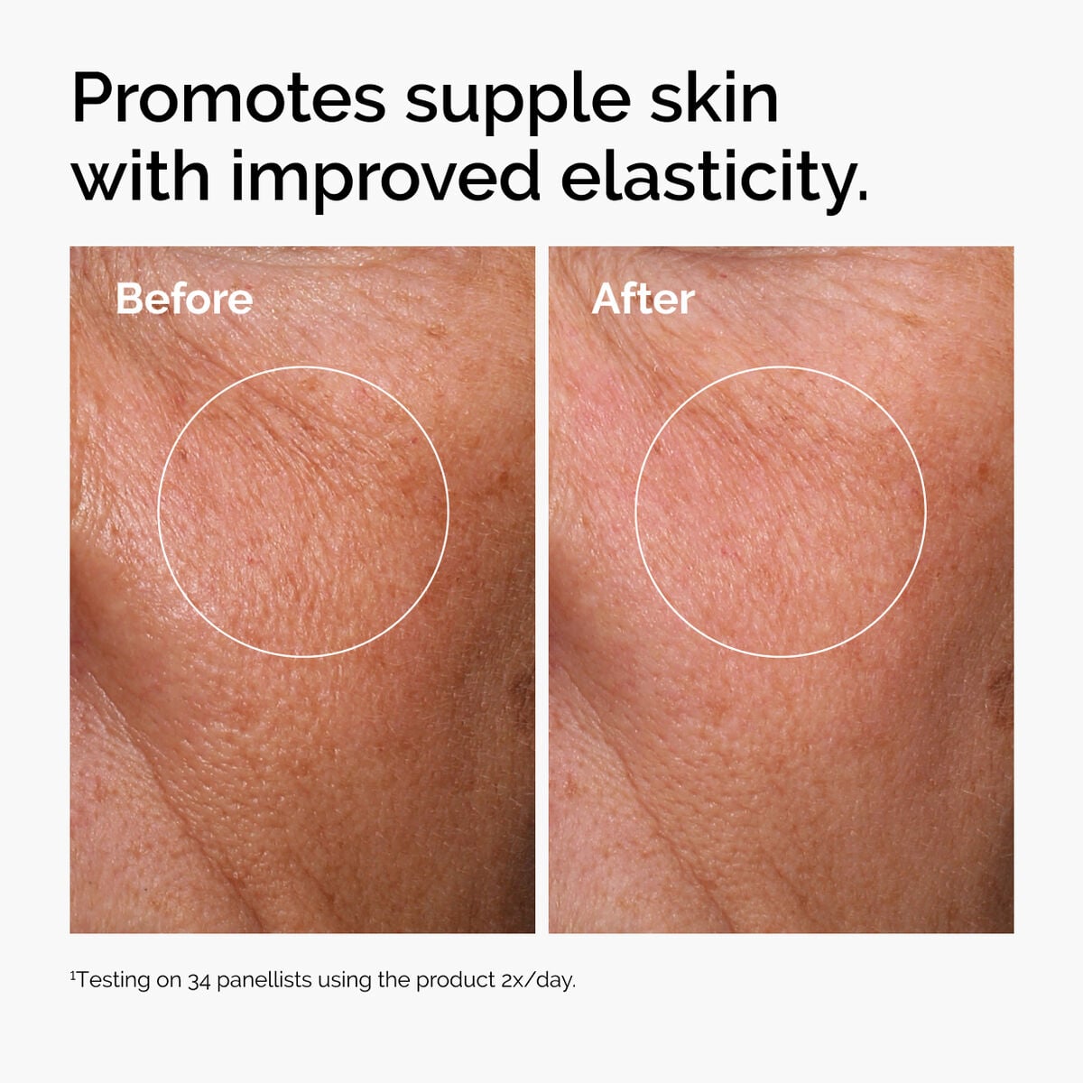 hyaluronic-acid-2-b5-with-ceramides-f3 ord-hyaluronic-acid-2pct-b5-hydrating-serum-before-after-elasticity.jpg