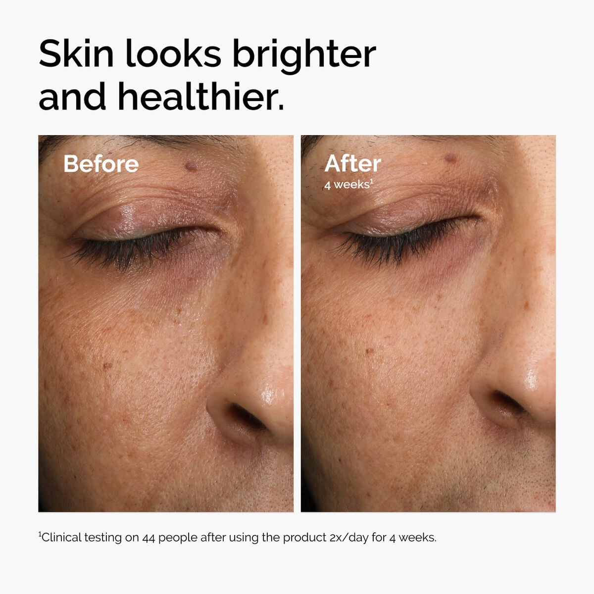 multi-antioxidant-radiance-serum-g9 ord-mars-before-after-healthy.jpg