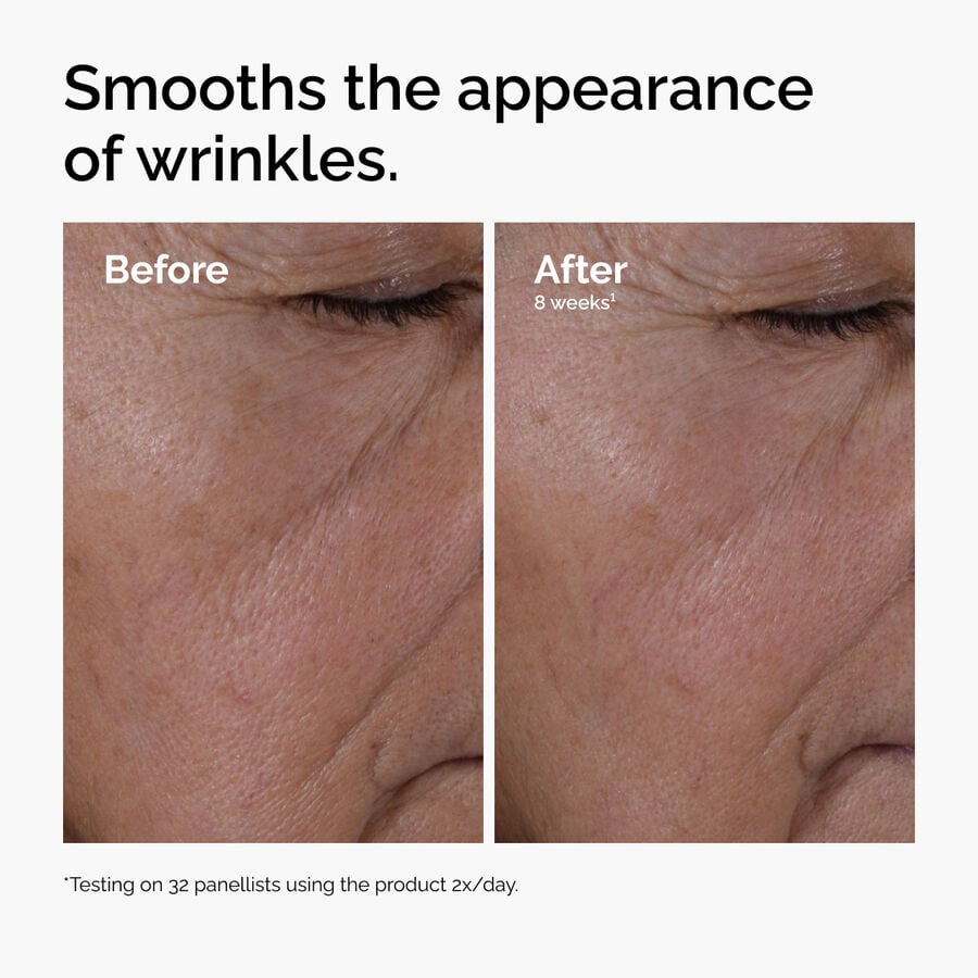 multi-peptide-ha-serum-l4 ord-multi-peptide-ha-serum-wrinkles-before-after.jpg