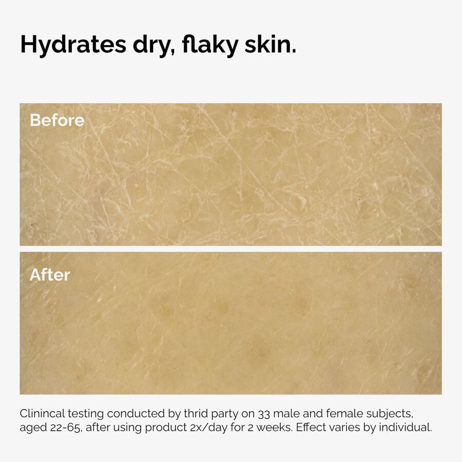the-body-care-collection-a9 ord-natural-moisturizing-factors-inulin-body-before-after-graphic-02.jpg