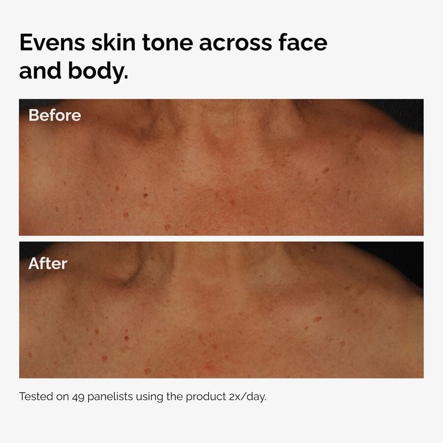 the-body-care-collection-a9 ord-niacinamide-face-body-serum-before-after-even-tone-graphic.jpg