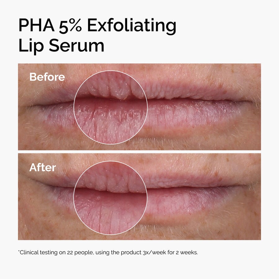pha-5-exfoliating-lip-serum-u5 ord-pha-5pct-lip-exfoliating-serum-before-after.jpg