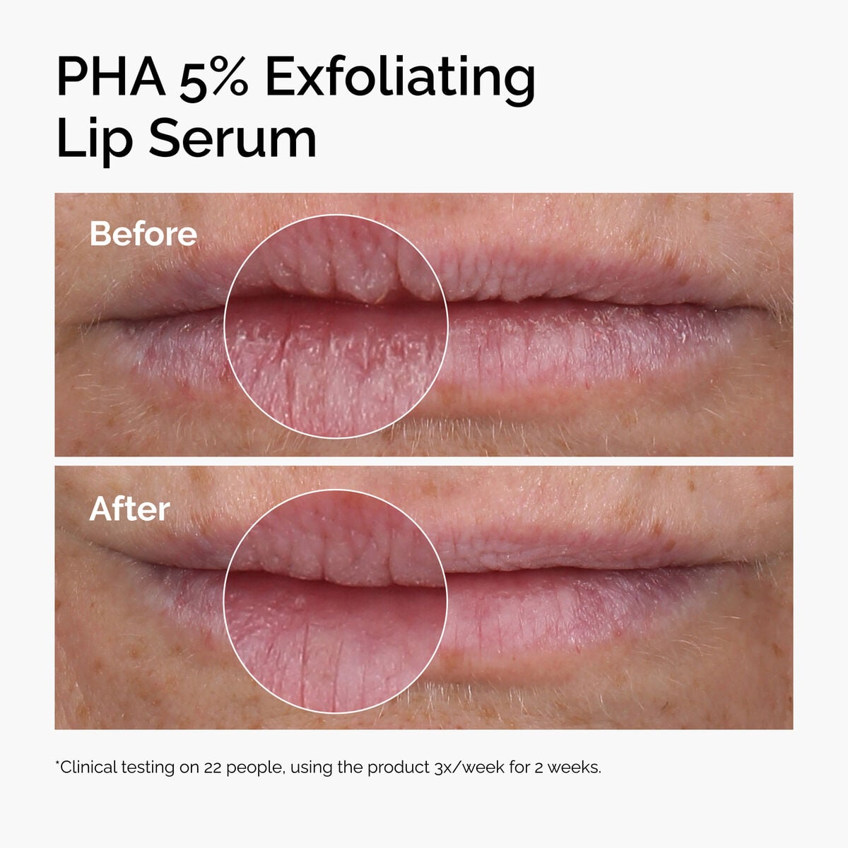 pha-5-exfoliating-lip-serum-u5 ord-pha-5pct-lip-exfoliating-serum-before-after.jpg