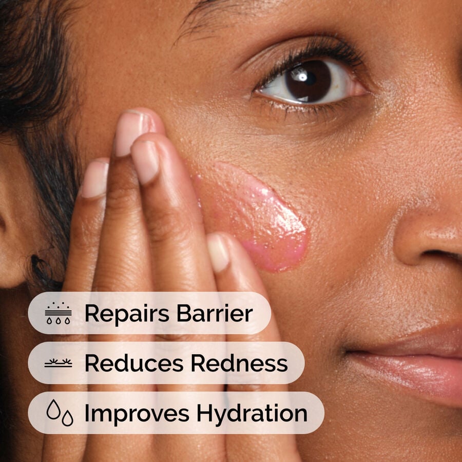 soothing-and-barrier-support-serum-r2 ord-soothing-barrier-support-serum-model-application-with-benefits.jpg