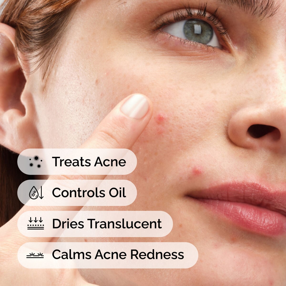 sulfur-10-powder-to-cream-concentrate-a7 ord-sulfur-10pct-powder-to-cream-concentrate-model-application-with-benefits-acne.jpg